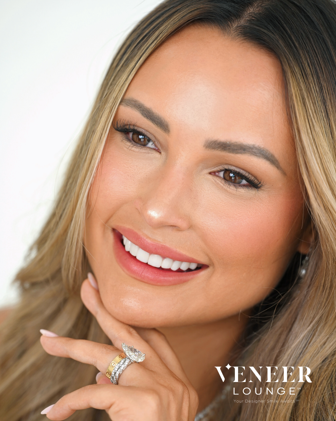 Veneer Lounge Austin smile